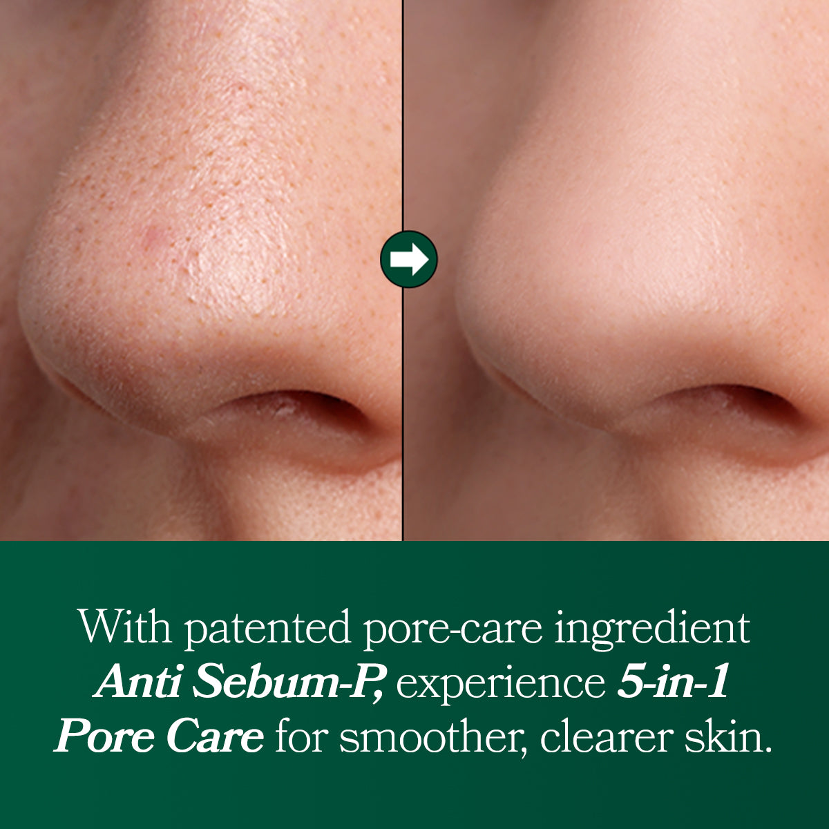 [Omitted] Fresh Lime Glow & Pore Refining Serum 50ml