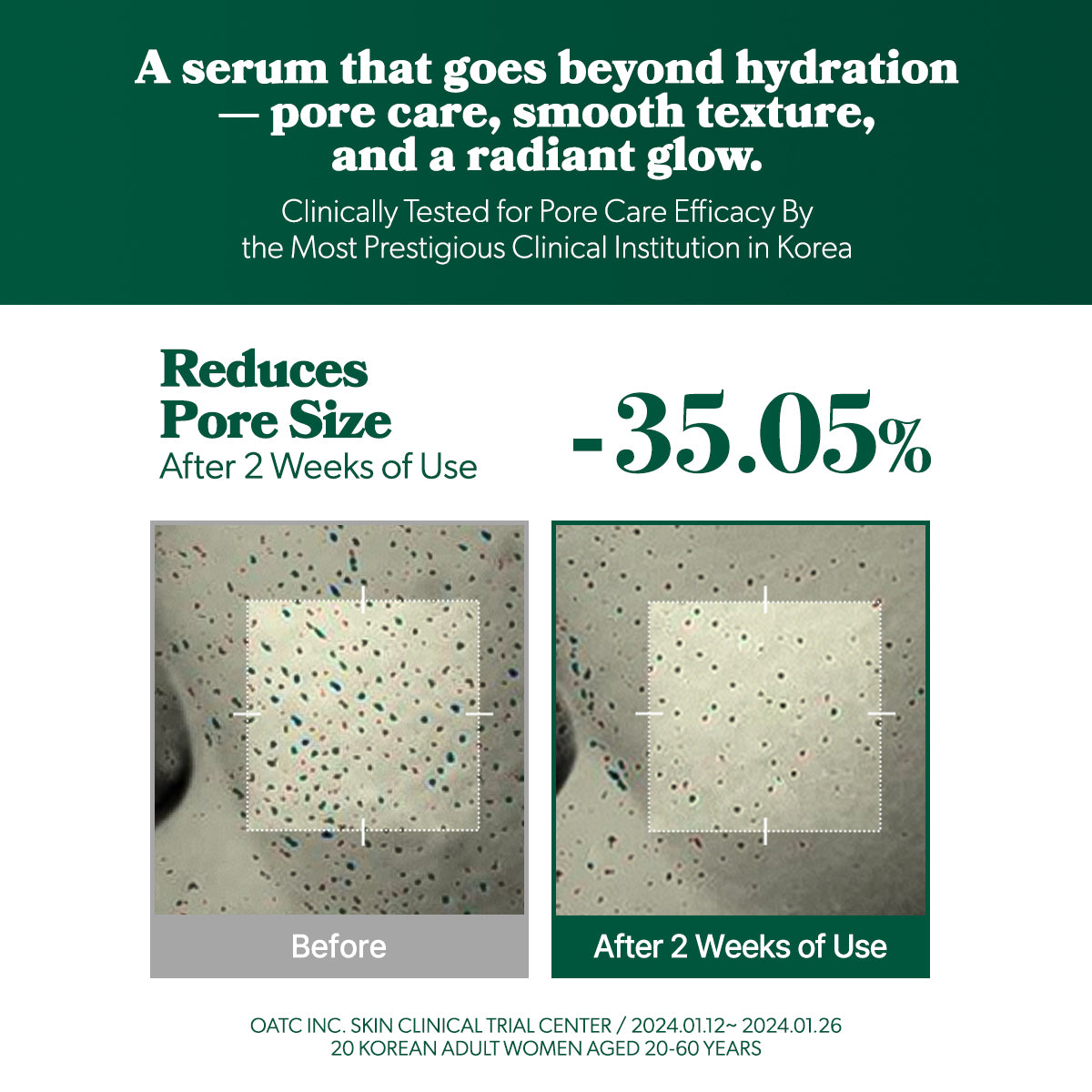 [Omitted] Fresh Lime Glow & Pore Refining Serum 50ml